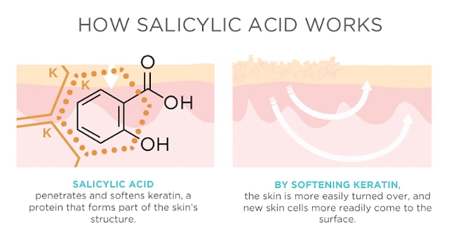 Acid salicylic là gì và hướng dẫn sử dụng - 2