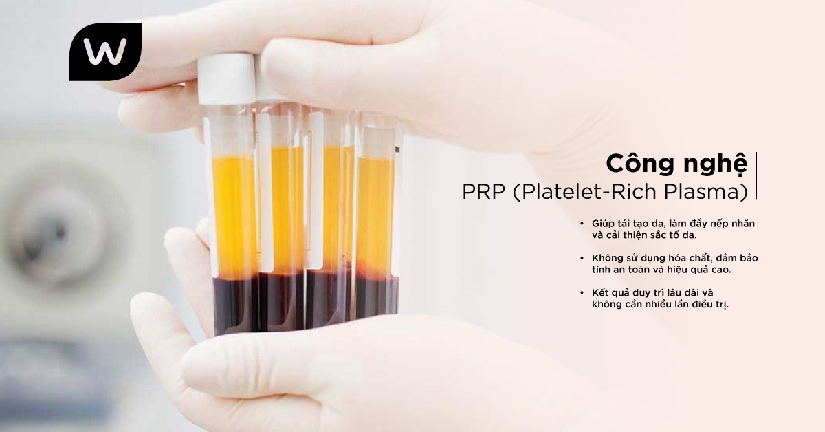 Công Nghệ PRP (Platelet-Rich Plasma)