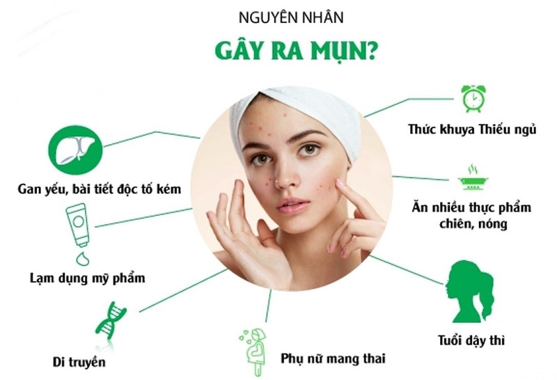 Sử dụng các sản phẩm hỗ trợ chăm sóc vùng da mụn