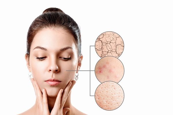 Cách “skincare” cho da nhạy cảm