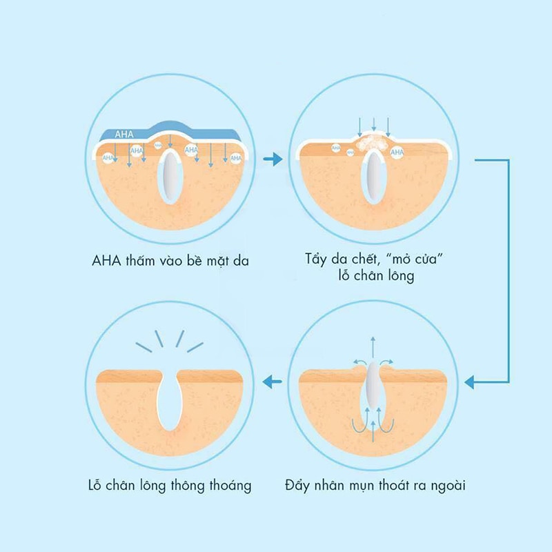 AHA có tác dụng gì cho làn da của bạn? - 2