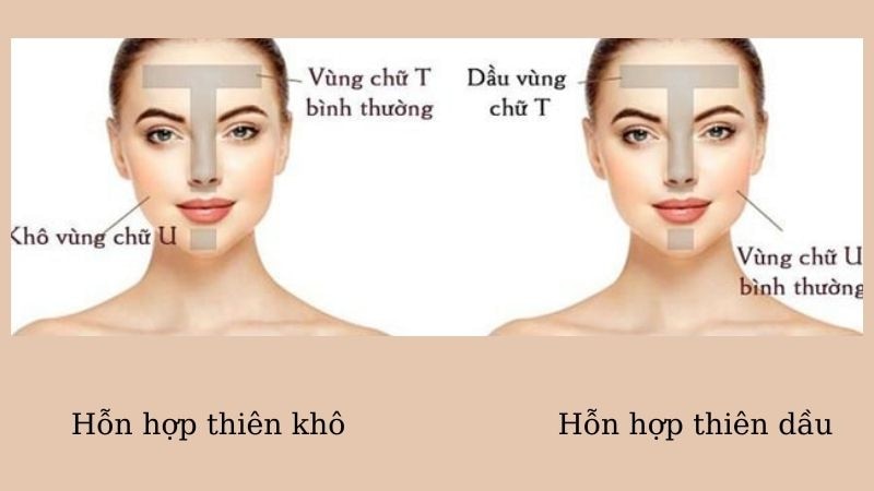 Da hỗn hợp là gì?