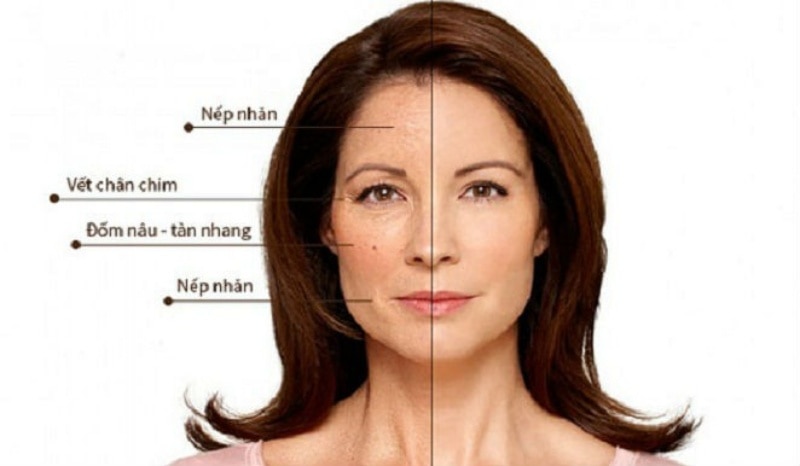 Những Thay Đổi Của Làn Da Ở Tuổi Trung Niên