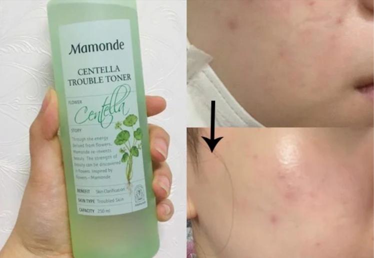 Mamonde Centella Trouble Toner chiết xuất từ rau má